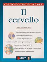 Il cervello