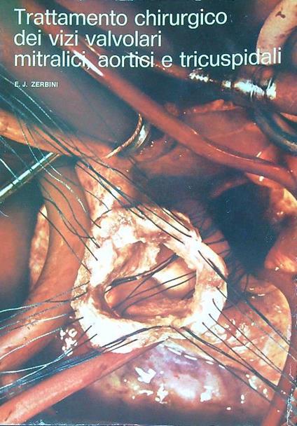 Trattamento chirurgico dei vizi valvolari mitralici, aortici e tricuspidali - copertina