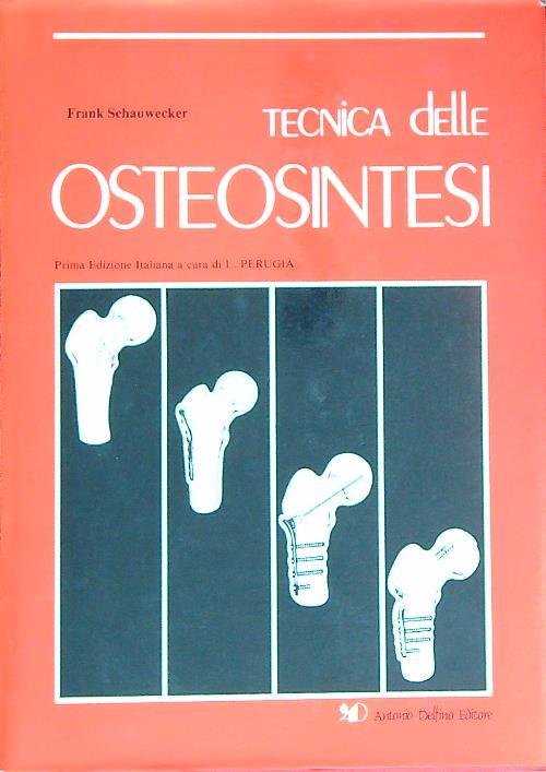 Tecnica delle osteosintesi