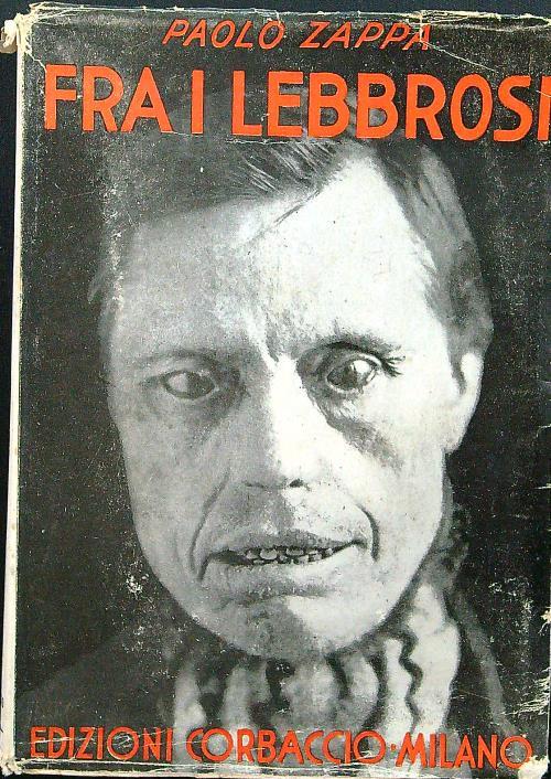 Fra i lebbrosi - Paolo Zappa - copertina