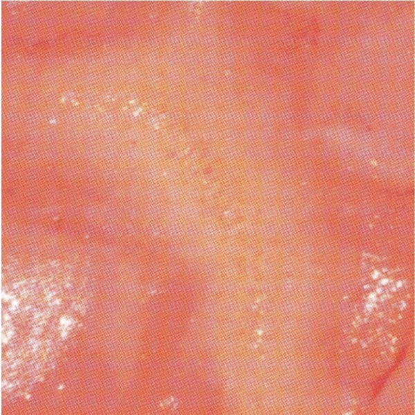 ibs