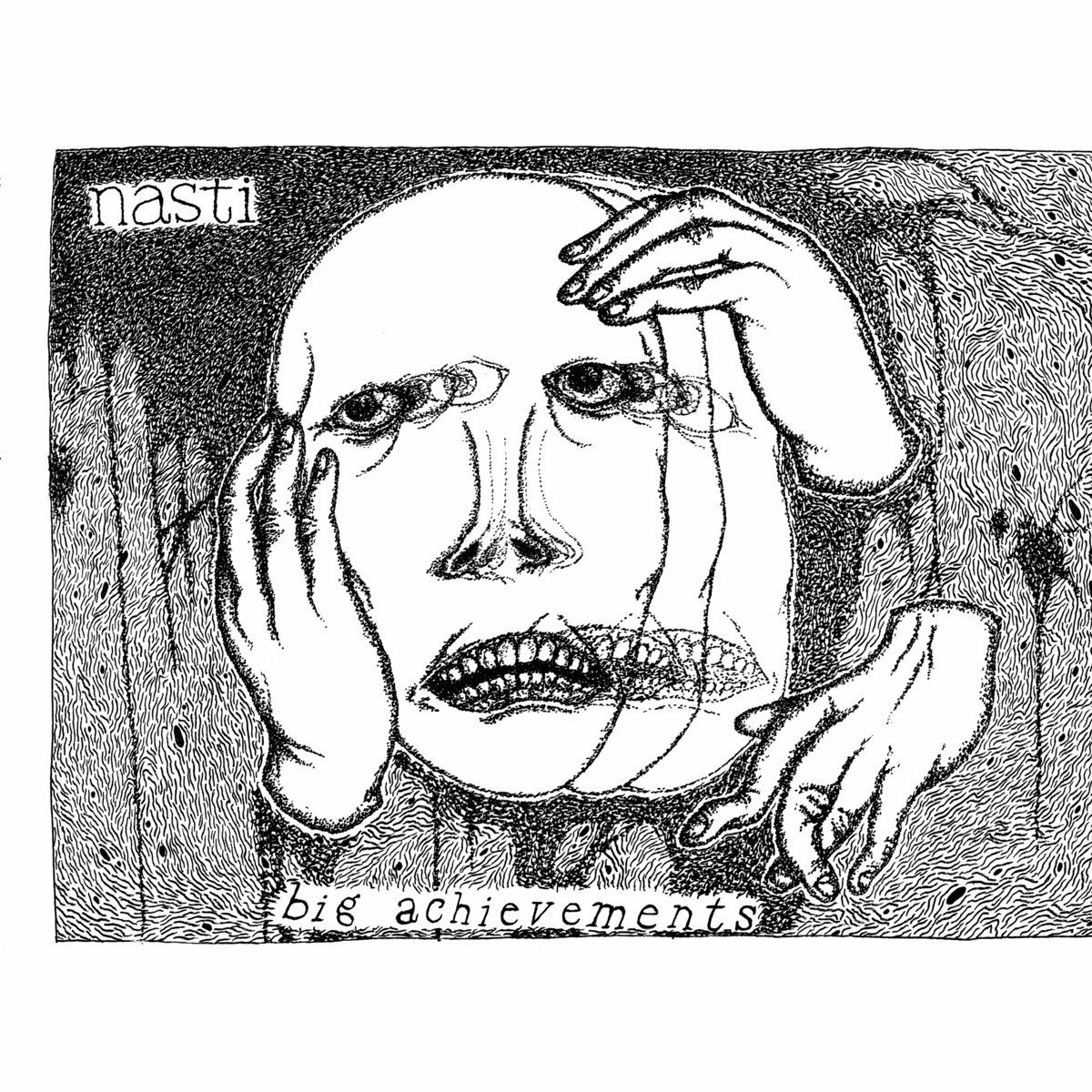 ibs