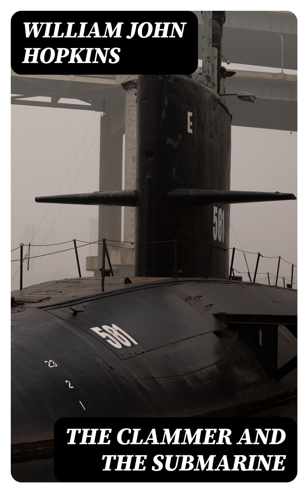 ibs