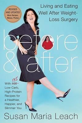 Before and After: Living and Eating Well After Weight-loss Surgery - Susan Maria Leach - cover