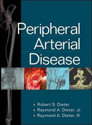 Peripheral arterial disease - copertina