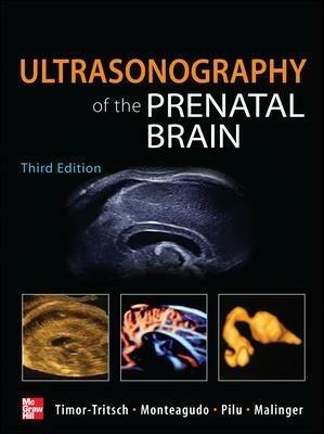 Ultrasonography of the prenatal & neonatal brain - Gustavo Malinger,Ana Monteagudo,Gianluigi Pilu - copertina