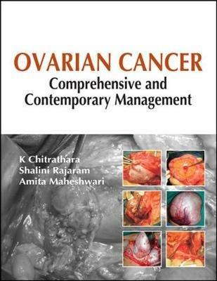 Ovarian cancer: comprehensive and contemporary management - K. Chitrathara,Shalini Rajaram,Amita Maheshwari - copertina