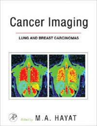 Cancer Imaging: Lung and Breast Carcinomas - M. A. Hayat - cover