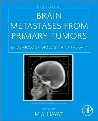 Brain Metastases from Primary Tumors, Volume 2: Epidemiology, Biology, and Therapy - cover