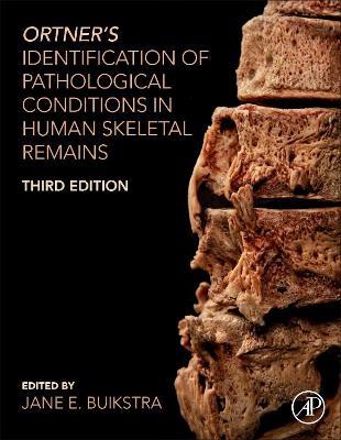 Ortner's Identification of Pathological Conditions in Human Skeletal Remains - cover