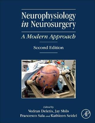 Neurophysiology in Neurosurgery: A Modern Approach - cover