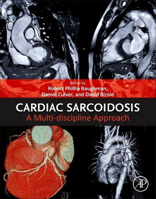 Cardiac Sarcoidosis: A Multi-discipline Approach - cover