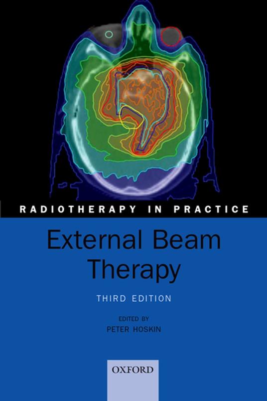 External Beam Therapy