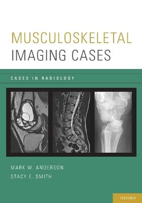 Musculoskeletal Imaging Cases - Mark W. Anderson,Stacy E. Smith - cover