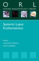 Systemic Lupus Erythematosus