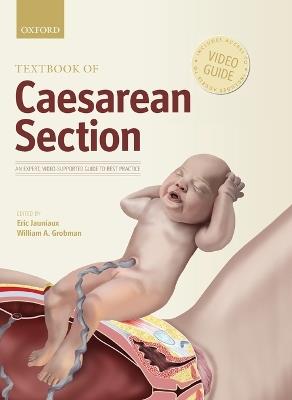 Textbook of Caesarean Section - cover