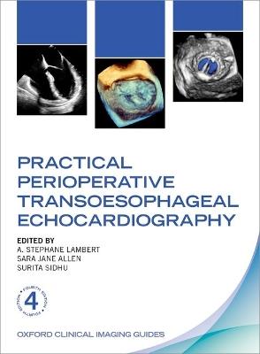 Practical Perioperative Transoesophageal Echocardiography - cover