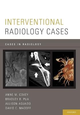 Interventional Radiology Cases - Anne M. Covey,Bradley P. Pua,Allison Aguado - cover