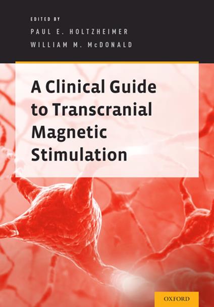 A Clinical Guide to Transcranial Magnetic Stimulation