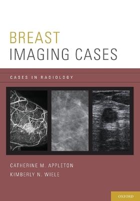 Breast Imaging Cases - Catherine M. Appleton,Kimberly N. Wiele - cover