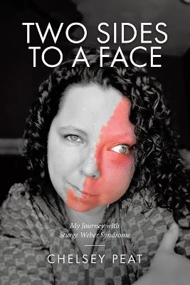 Two Sides to a Face: My Journey with Sturge Weber Syndrome - Chelsey Peat - cover