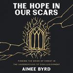 The Hope in Our Scars