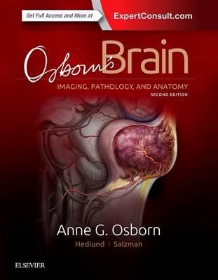 Osborn's Brain - Anne G. Osborn,Gary L. Hedlund,Karen L. Salzman - cover