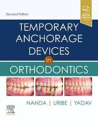 Temporary Anchorage Devices in Orthodontics - cover