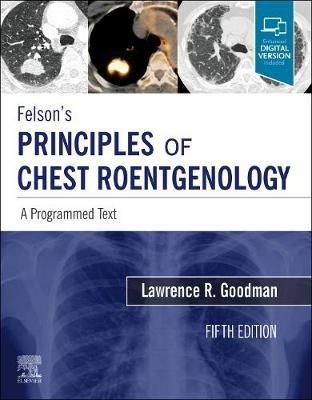 Felson's Principles of Chest Roentgenology, A Programmed Text: A Programmed Text - Lawrence R. Goodman - cover
