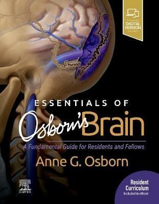 Essentials of Osborn's Brain: A Fundamental Guide for Residents and Fellows - Anne G. Osborn - cover
