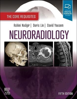 Neuroradiology: The Core Requisites - cover