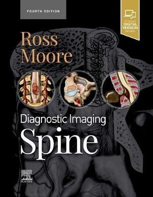 Diagnostic Imaging: Spine - Jeffrey S. Ross,Kevin R. Moore - cover