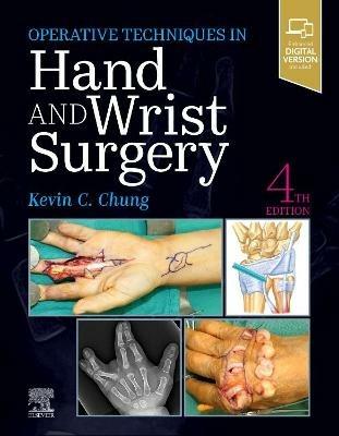 Operative Techniques: Hand and Wrist Surgery - Kevin C. Chung - cover