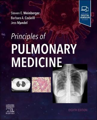 Principles of Pulmonary Medicine - Steven E. Weinberger,Barbara A. Cockrill,Jess Mandel - cover