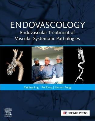 Endovascology: Endovascular Treatment of Vascular Systematic Pathologies - Zaiping Jing,Rui Feng,Jiaxuan Feng - cover