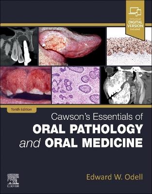 Cawson's Essentials of Oral Pathology and Oral Medicine - Edward W Odell - cover