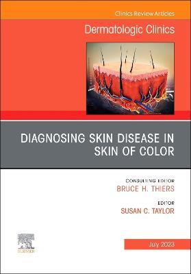 Diagnosing Skin Disease in Skin of Color, An Issue of Dermatologic Clinics - cover