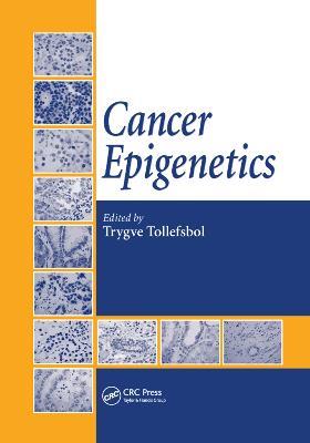 Cancer Epigenetics - cover