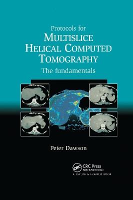 Protocols for Multislice Helical Computed Tomography: The Fundamentals - Dawson Peter - cover