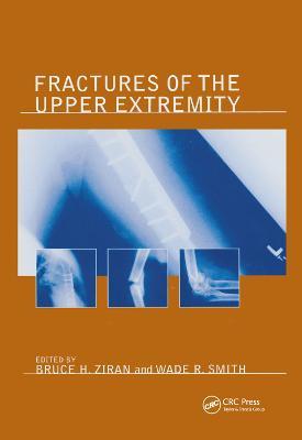 Fractures of the Upper Extremity - cover
