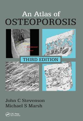 An Atlas of Osteoporosis - John C. Stevenson,Michael S. Marsh - cover