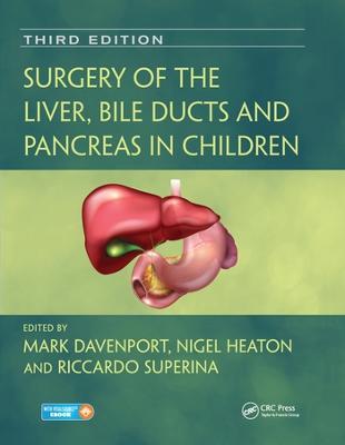 Surgery of the Liver, Bile Ducts and Pancreas in Children - cover