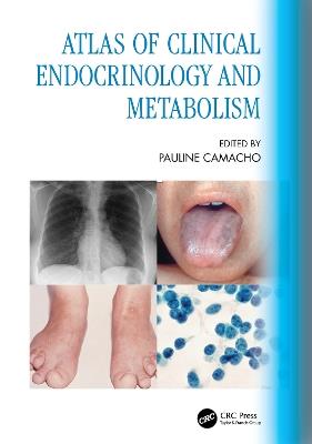 Atlas of Clinical Endocrinology and Metabolism - cover