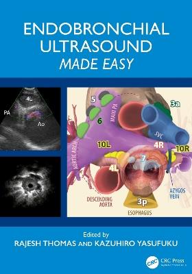Endobronchial Ultrasound Made Easy - cover