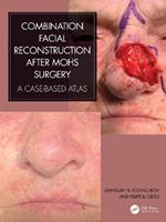 Combination Facial Reconstruction after Mohs Surgery: A Case Based Atlas