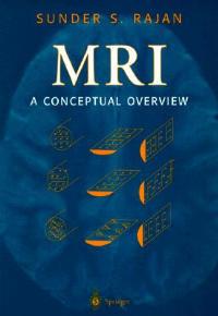 MRI: A Conceptual Overview - Sunder S. Rajan - cover