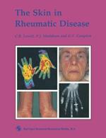 The Skin in Rheumatic Disease