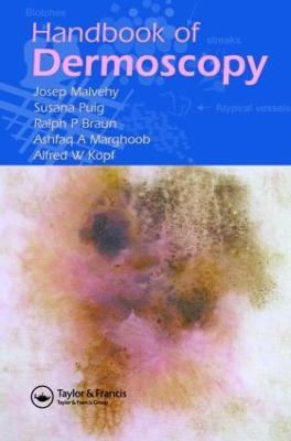 Handbook of Dermoscopy - Josep Malvehy,Ralph P. Braun,Susana Puig - cover