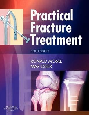 Practical Fracture Treatment - Ronald McRae,Max Esser - cover