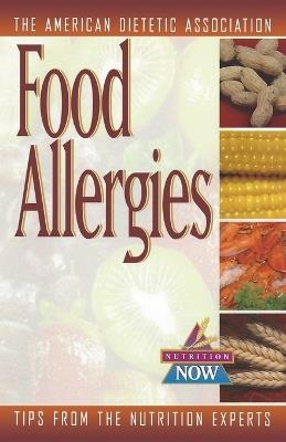 Food Allergies - ADA (American Dietetic Association),Celide Barnes Koerner,Anne Munoz-Furlong - cover